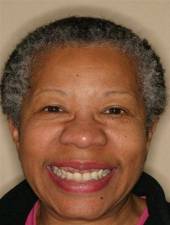 Б.Дж. Харрисон